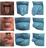 3D human tongue reconstruction from single ''in-the-wild'' images